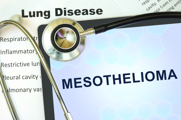 different names for mesothelioma